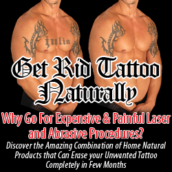 get rid tattoo review
