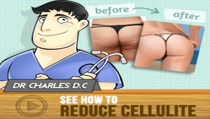 Cellulite Factor Review